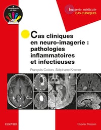 Cas cliniques en neuro-imagerie : pathologies inflammatoires et infectieuses: Path Inflammat Et Infectieuses - Professeur François Cotton (2018)