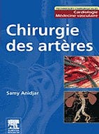 Chirurgie des artères - Samy Anidjar