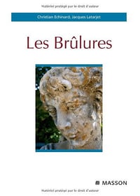 Les brûlures - Christian Echinard