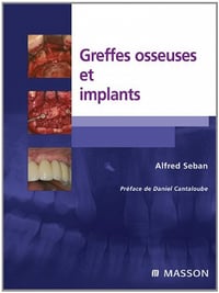 Greffes osseuses et implants - Alfred Seban