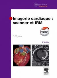Imagerie Cardiaque : Scanner et IRM - Olivier Vignaux