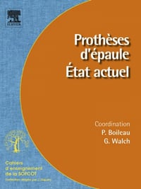 Prothèses d’épaule. État actuel - Pascal Boileau; Gilles Walch
